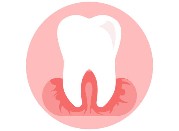 Gum Disease: Causes, Symptoms, and Treatment Options